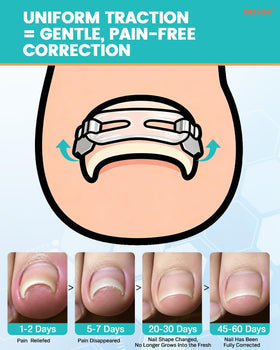 BEZOX traction hooks close-up with visible hooks and secure grip benefit