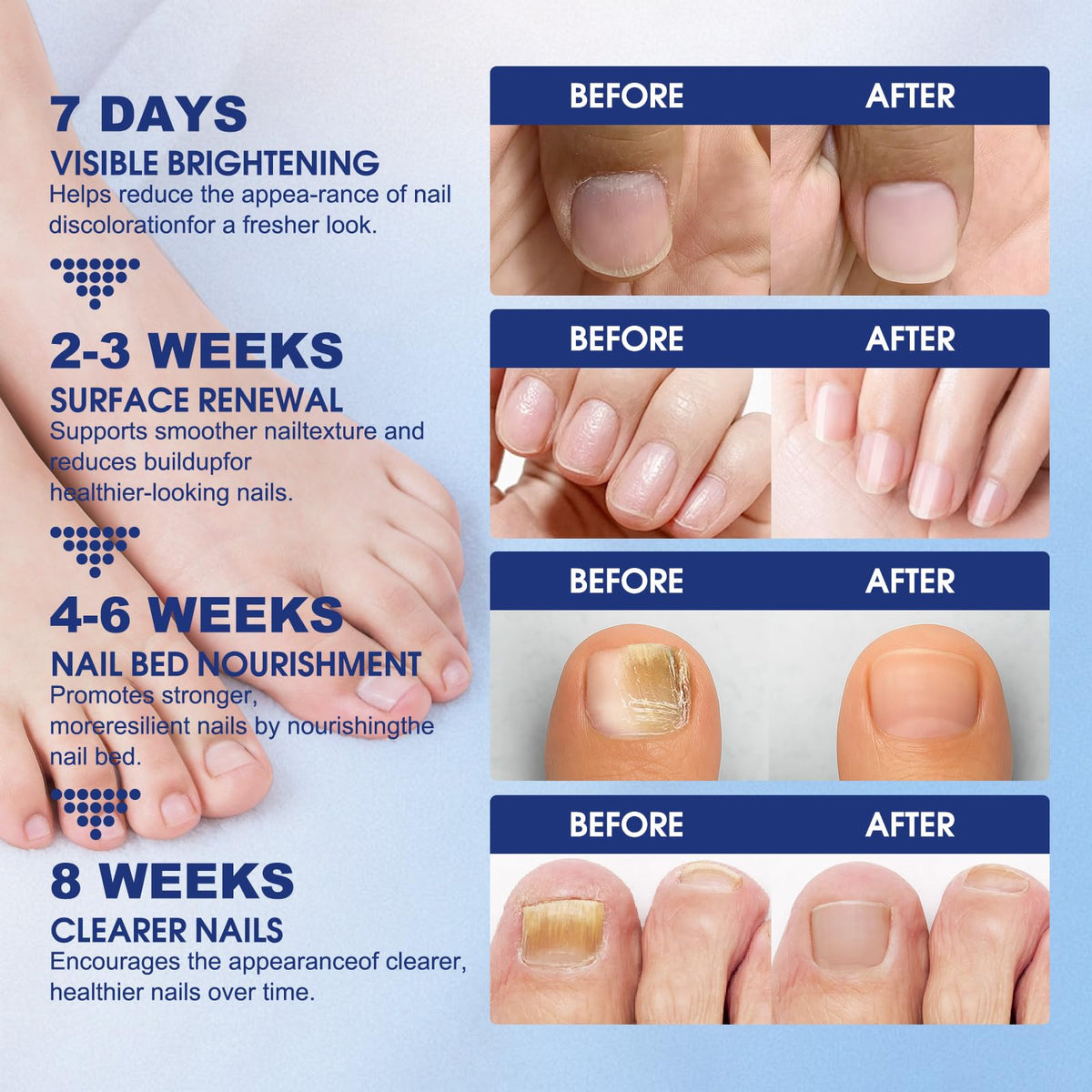 bfgckj applying patch to a clean toenail demonstrating easy painless use