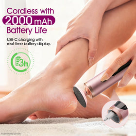 Bicboz close-up of sandpaper disc texture for effective callus removal