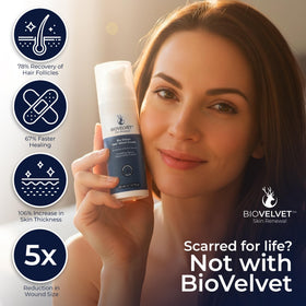 Bio Velvet being applied to hand demonstrating fast absorption and immediate comfort