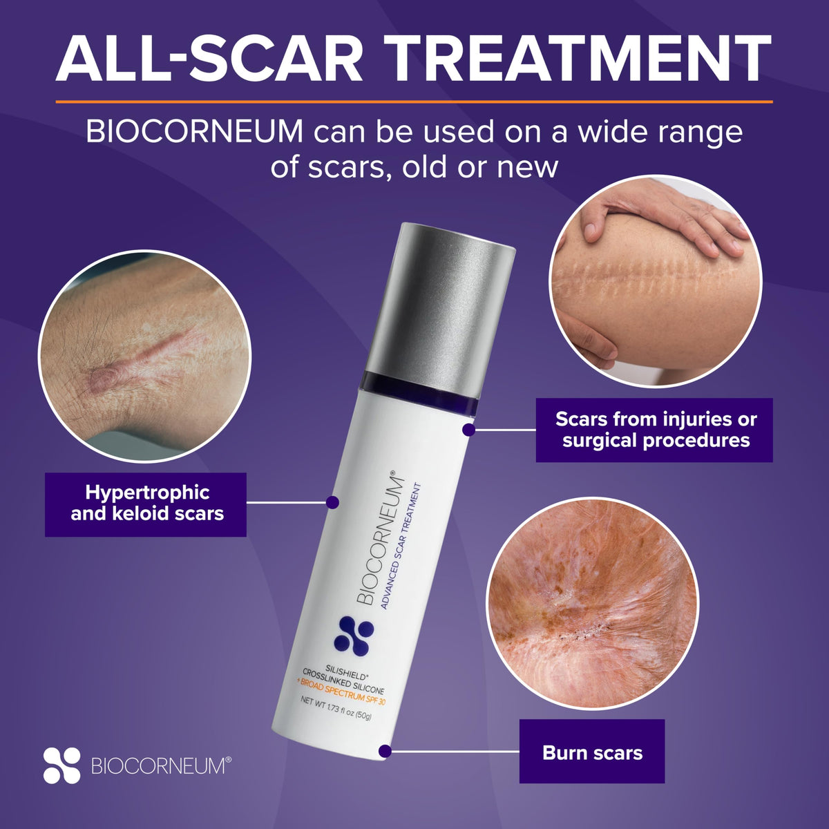 BIOCORNEUM dried film on skin showing water-resistant, breathable protective layer