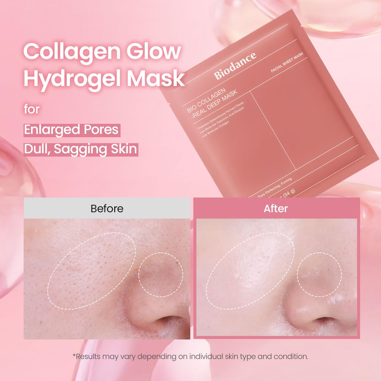 BIODANCE mask applied on face overnight demonstrating comfortable fit