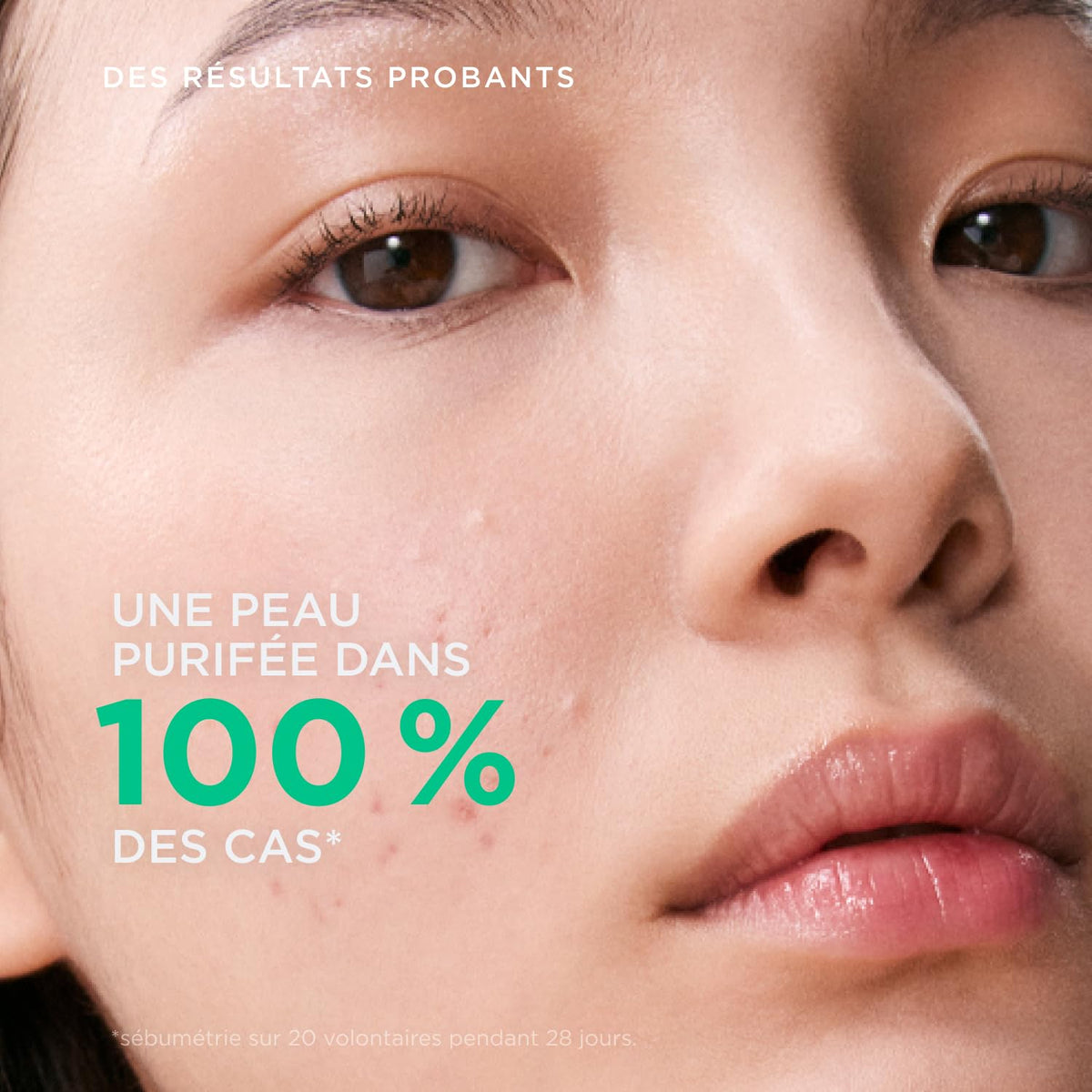 Bioderma Sébium foam texture on hand demonstrating gentle non-drying cleanse benefit