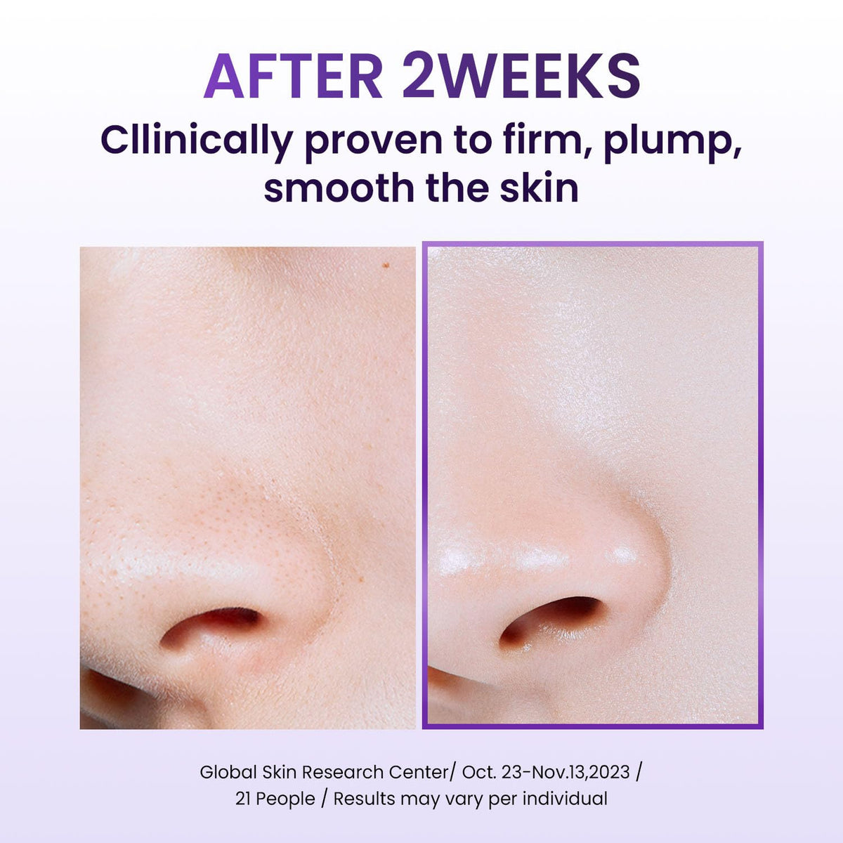 BIOHEAL BOH collagen capsules detail highlighting nano capsule technology benefit