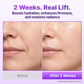 BIOHEAL BOH label and ingredients panel highlighting product transparency