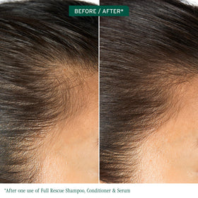 Biolage dropper closeup dispensing a precise drop for targeted scalp dosing