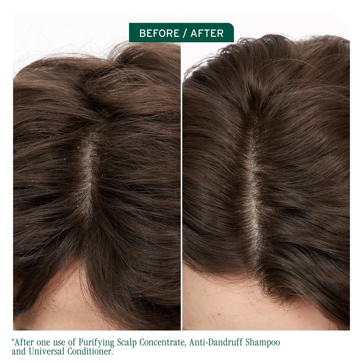 Biolage nozzle application close-up demonstrating precise scalp targeting
