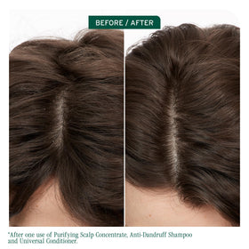 Biolage nozzle application close-up demonstrating precise scalp targeting