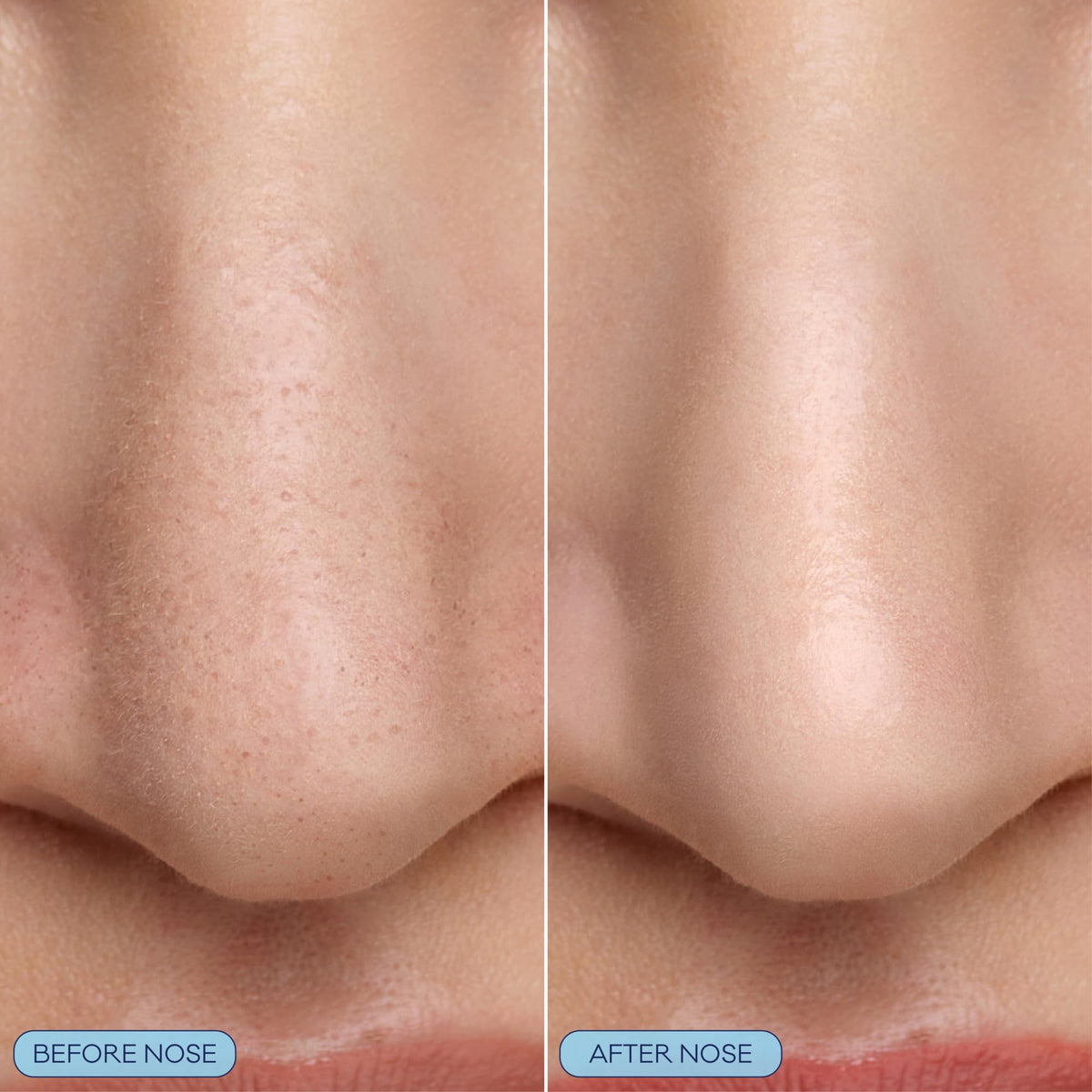 Biore silicone scrubber detail demonstrating gentle physical exfoliation benefit