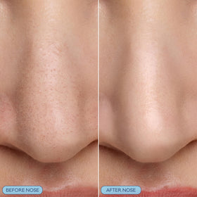 Biore silicone scrubber detail demonstrating gentle physical exfoliation benefit