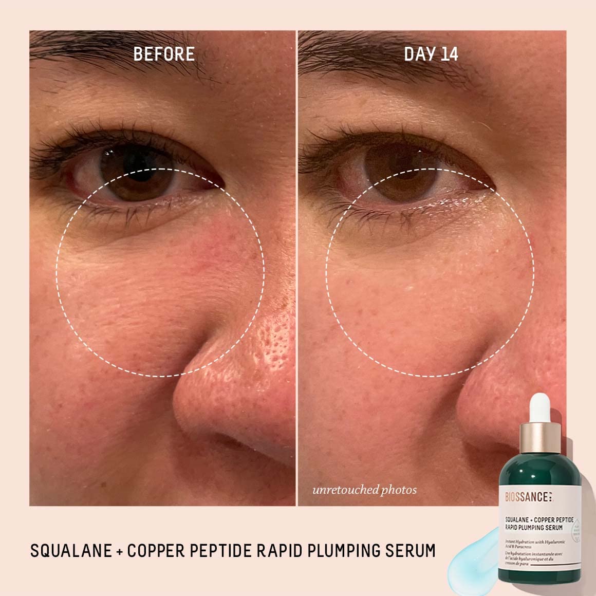 Biossance before and after texture comparison showing firmer appearing skin