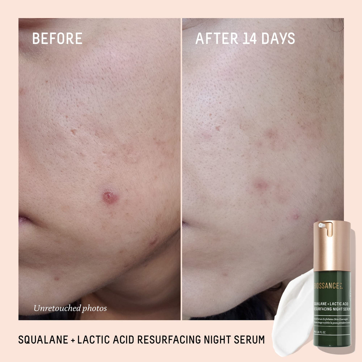BIOSSANCE dropper dispensing serum highlighting controlled, mess-free application