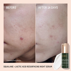 BIOSSANCE dropper dispensing serum highlighting controlled, mess-free application