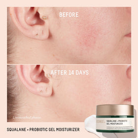 Biossance gel on fingertip showing spreadable formula for non-greasy finish benefit
