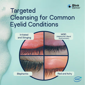 BlinkBetter ingredient label close-up highlighting soothing, hydrating actives