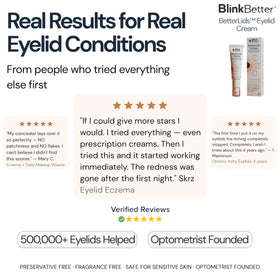 BlinkBetter paired with ointment for night routine illustrating round-the-clock hydration strategy