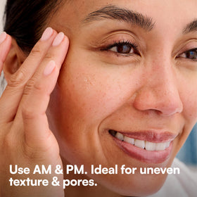 Bliss before and after skin texture comparison showing smoother look