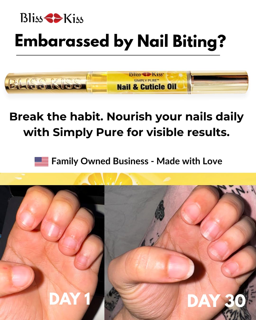 Bliss Kiss pen held during application to cuticle for targeted hydration
