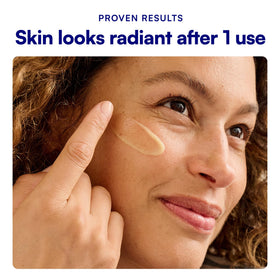 Bliss before and after comparison displaying improved texture and radiance