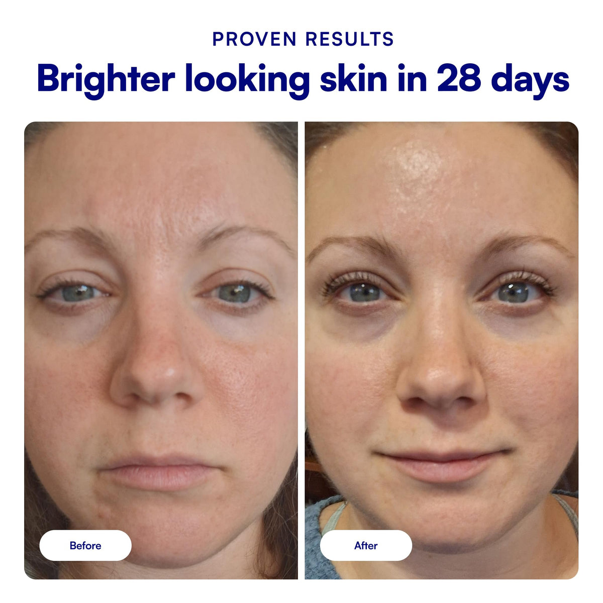 Bliss serum dropper dispensing formula for precise application benefit
