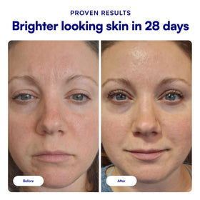 Bliss serum dropper dispensing formula for precise application benefit