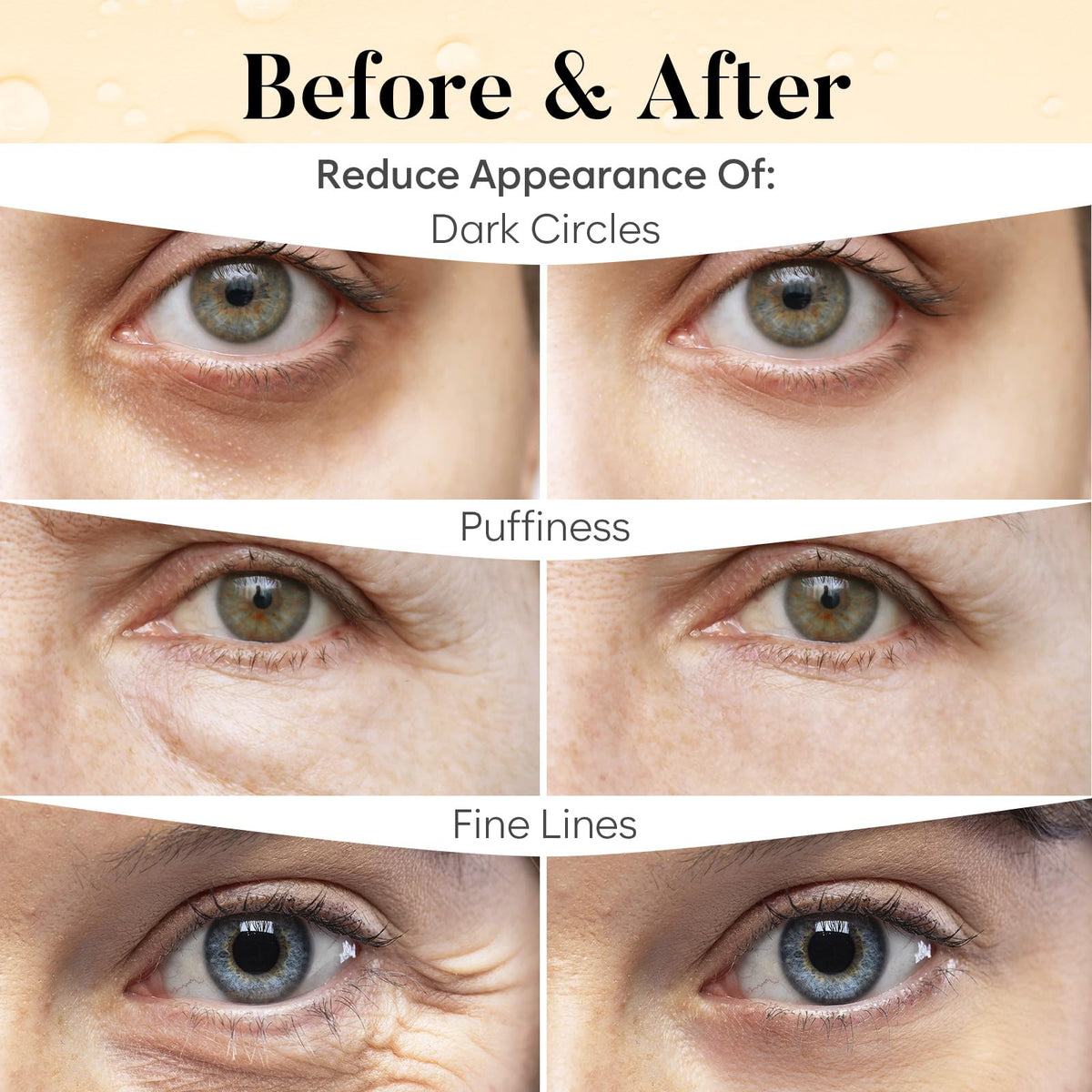BLOOMORA patch applied under eye demonstrating comfortable fit and lift