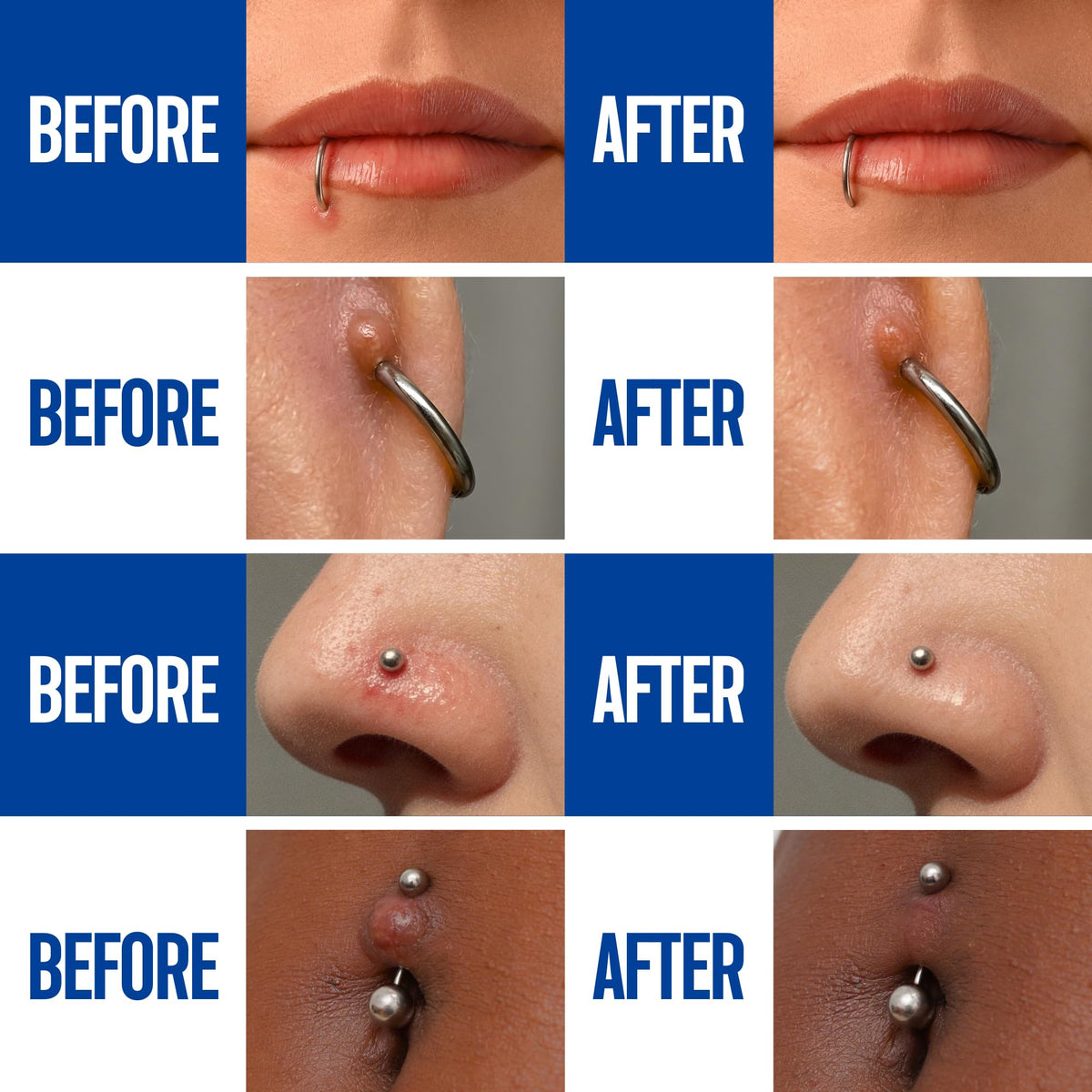 BodyJ4You spray being applied to an ear piercing for convenient care