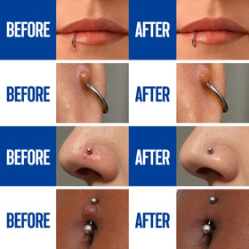 BodyJ4You spray being applied to an ear piercing for convenient care