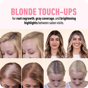 Boldify before and after hairline comparison showing visible improvement and fuller-looking hair