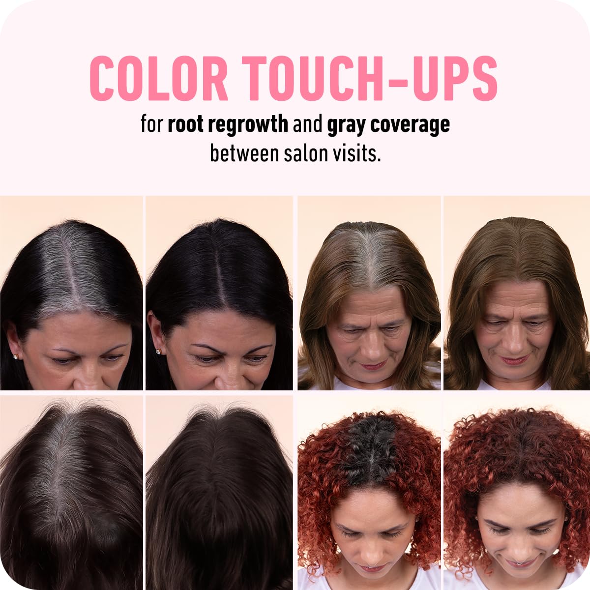 Boldify product applied at hairline demonstrating visible thinning coverage and confidence