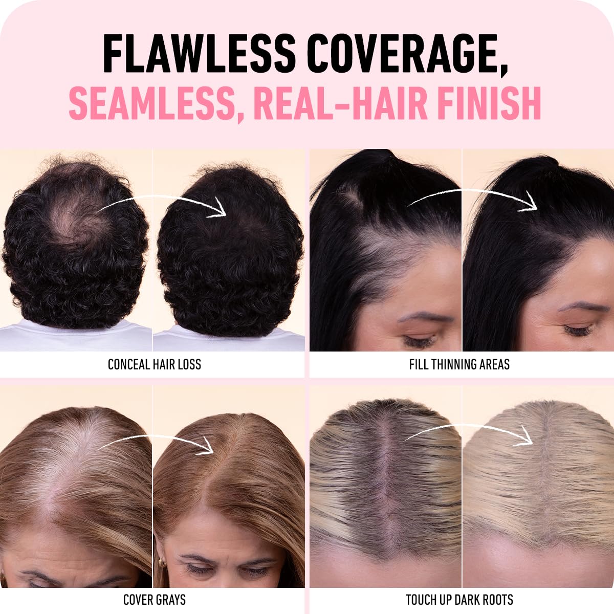 Boldify label close-up listing squalene to show scalp-friendly, lightweight nourishment