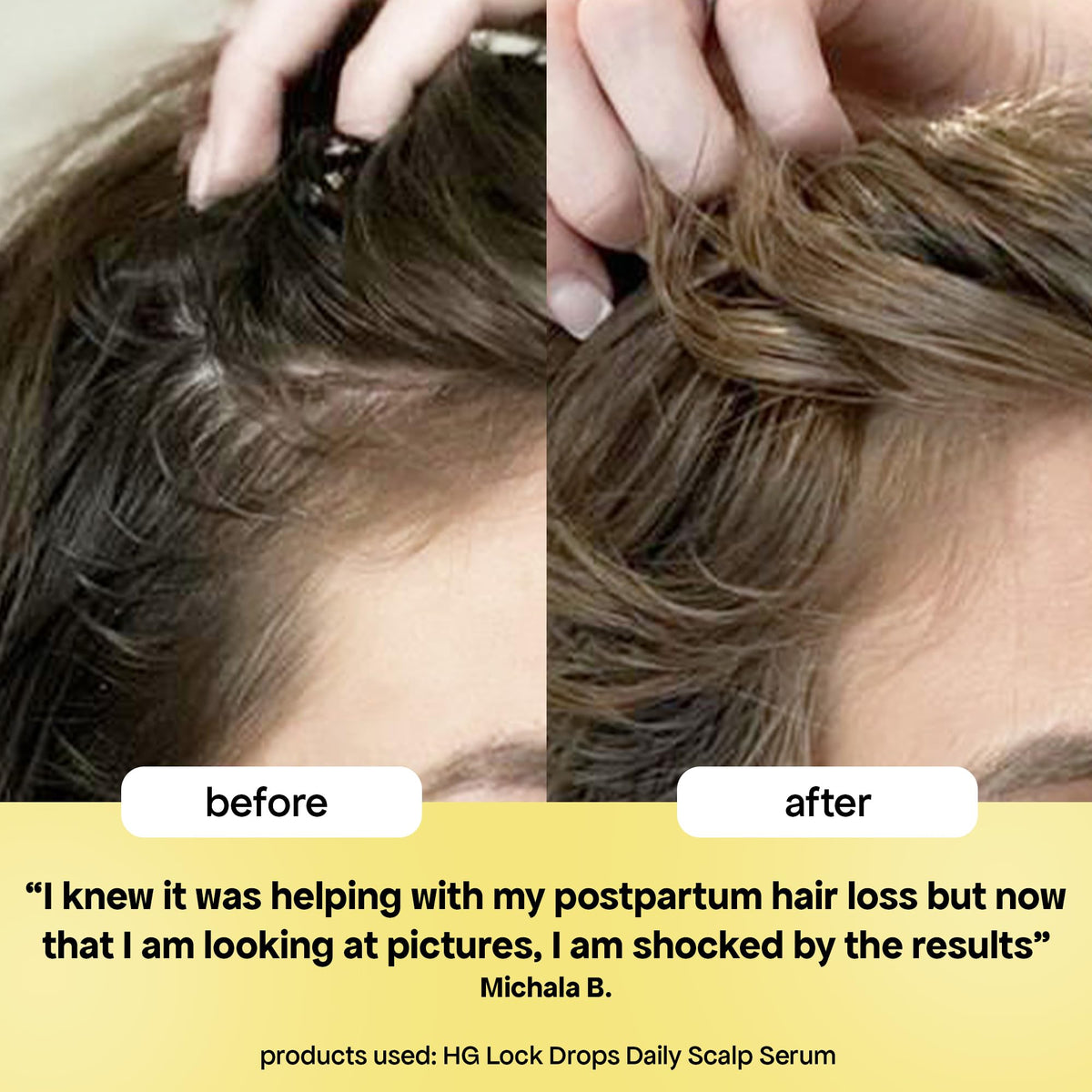 BondiBoost paired with HG shampoo and conditioner for boosted routine benefit