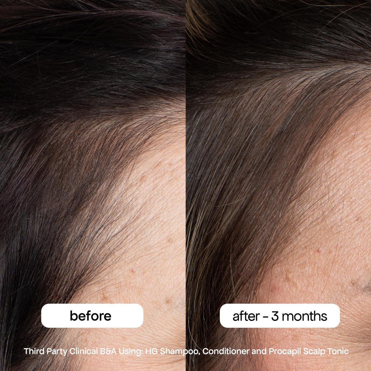 BONDIBOOST shampoo foam lather illustrating gentle cleansing without sulfates