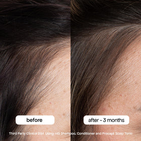 BONDIBOOST shampoo foam lather illustrating gentle cleansing without sulfates