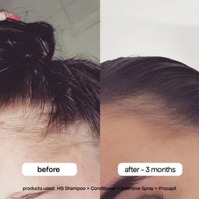 BONDIBOOST being sprayed at roots for targeted density benefit