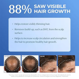 BosleyMD BosRevive in-use in shower demonstrating scalp refresh benefit