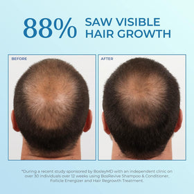 BosleyMD spray being applied to scalp demonstrating targeted coverage benefit