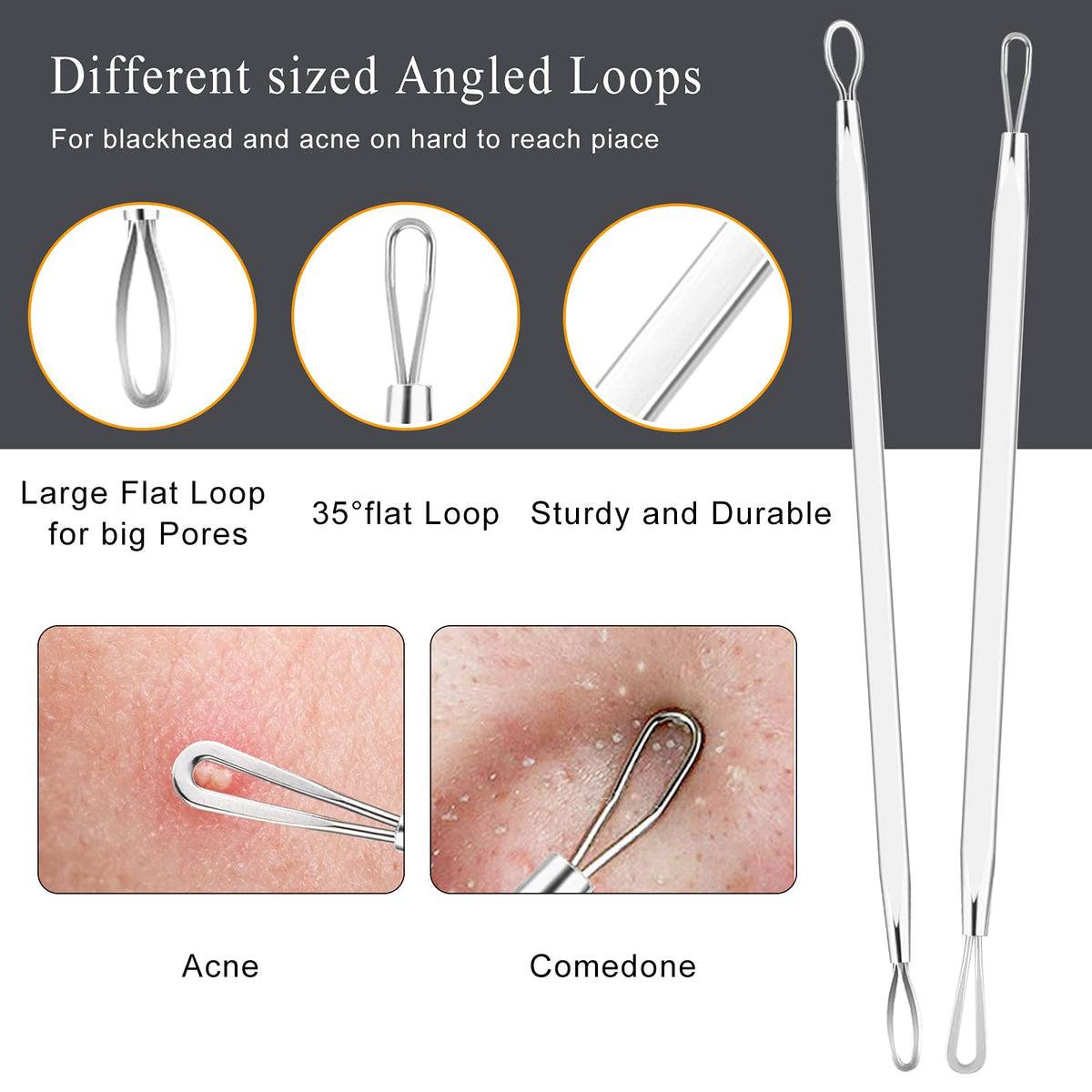 Boxoyx close-up of loop extractor tip for precise blackhead removal