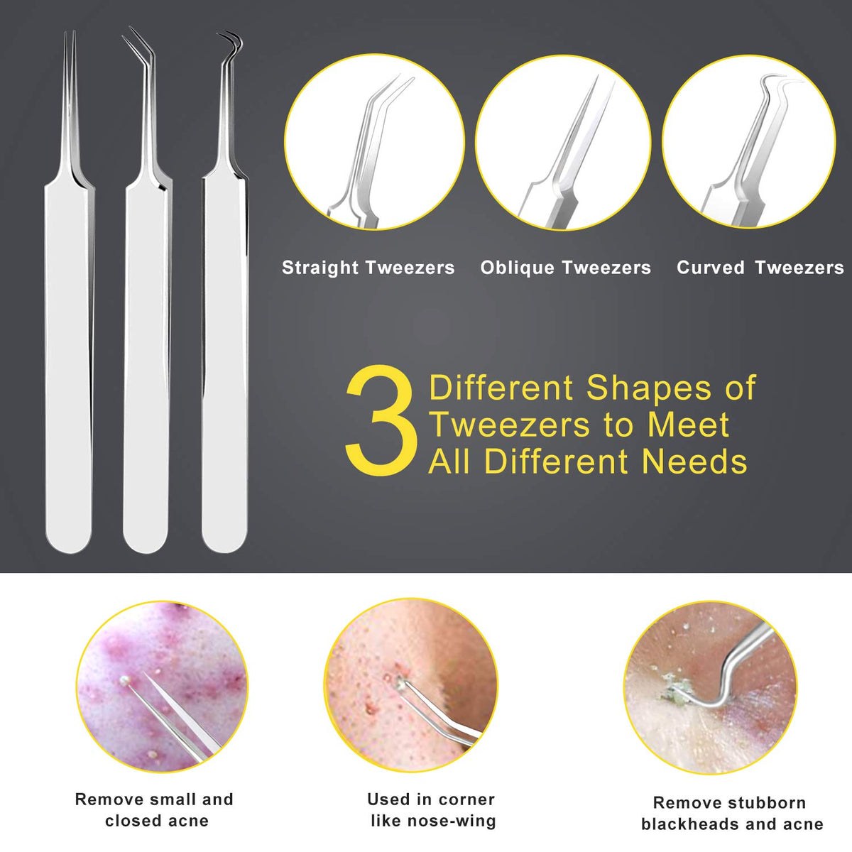 Boxoyx close-up of loop tip showing precise edge for gentle blackhead extraction