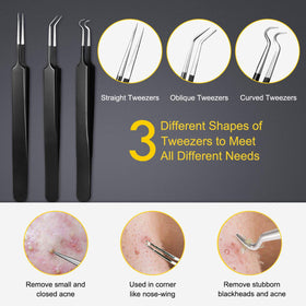 Boxoyx loop tip detail showing precise extraction edge for controlled blackhead removal