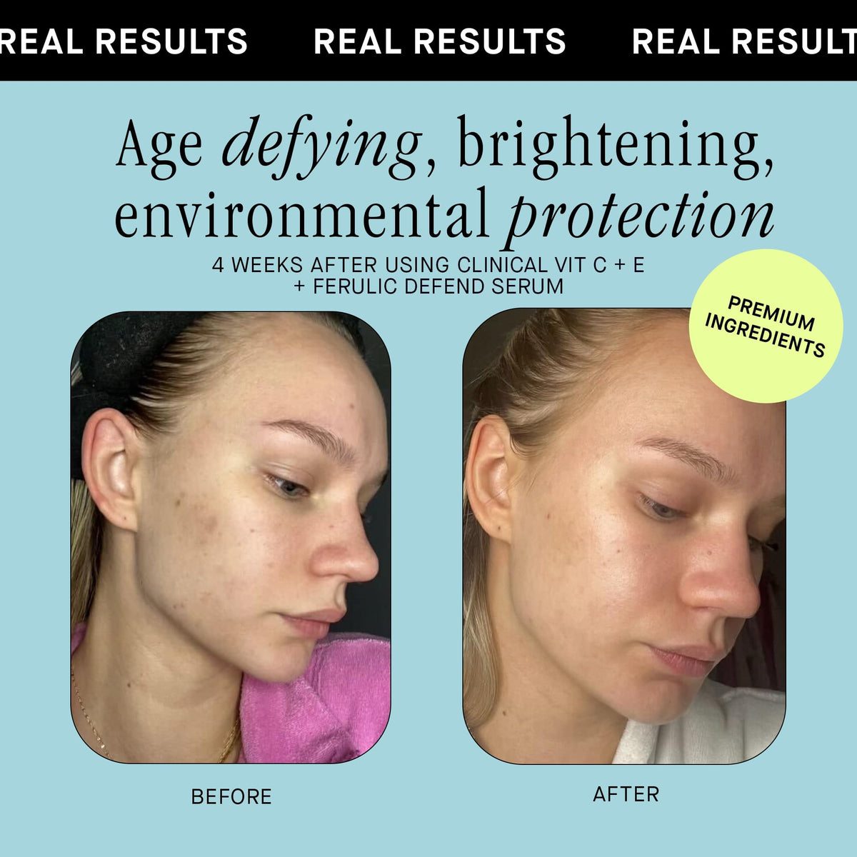 Brandefy before and after illustration showing reduced dark spots and improved brightness