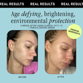 Brandefy before and after illustration showing reduced dark spots and improved brightness