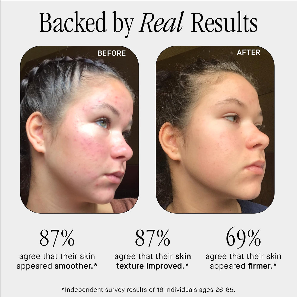 Brandefy serum texture close-up showing lightweight, hydrating gel