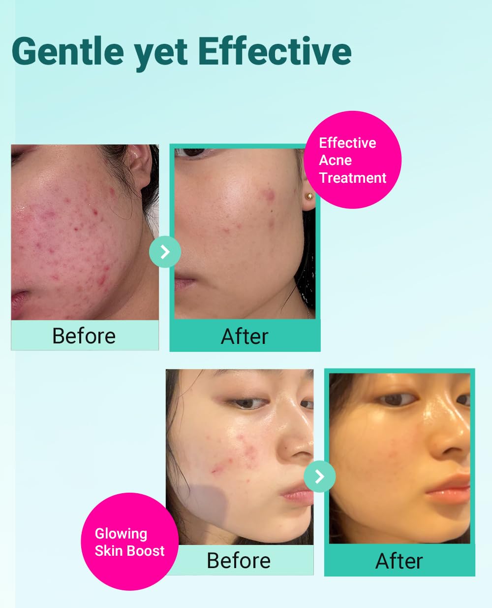 BRING GREEN Tea Tree Cica Cream open view showing smooth non-greasy hydration