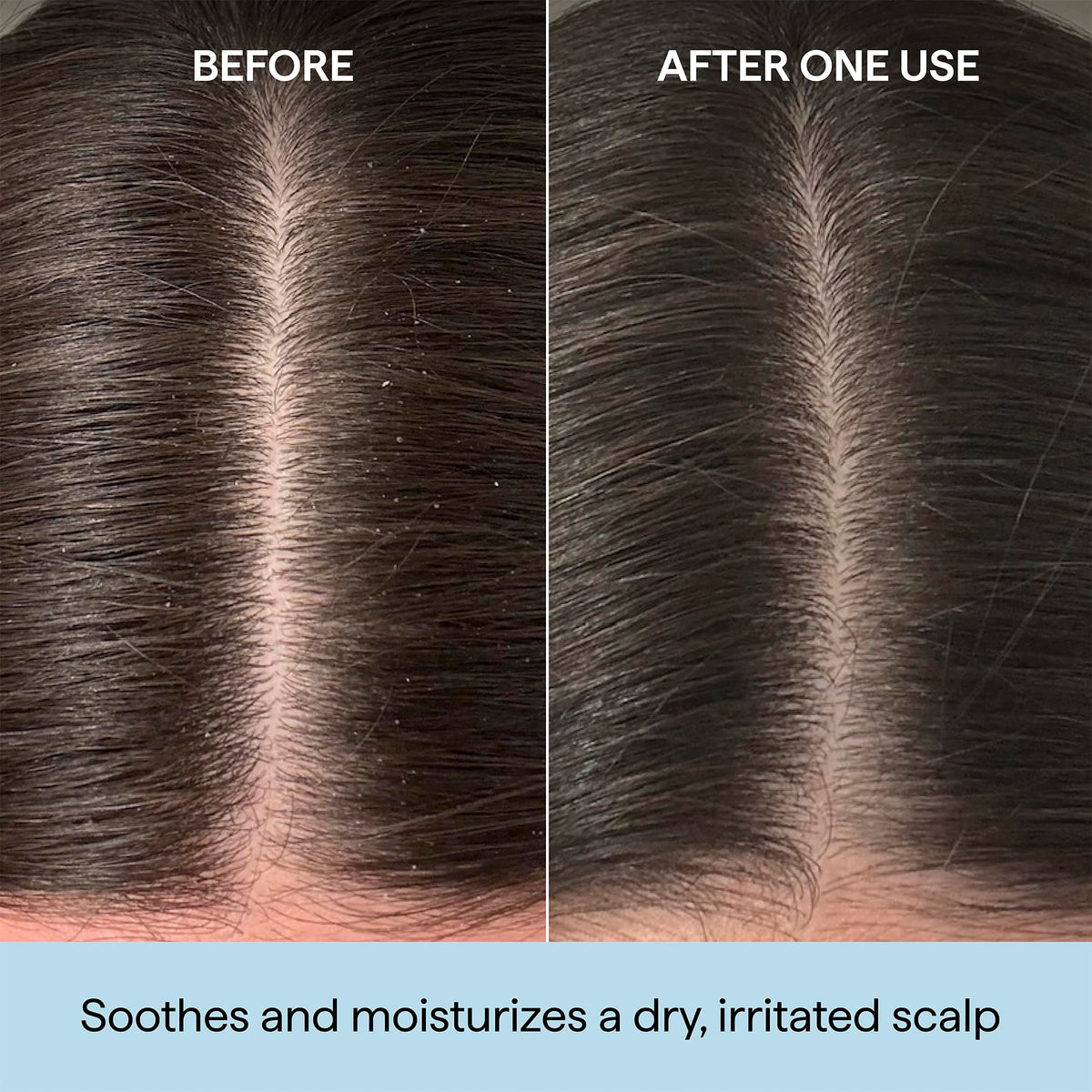 Briogeo close-up of precision applicator tip for direct scalp placement and minimal waste