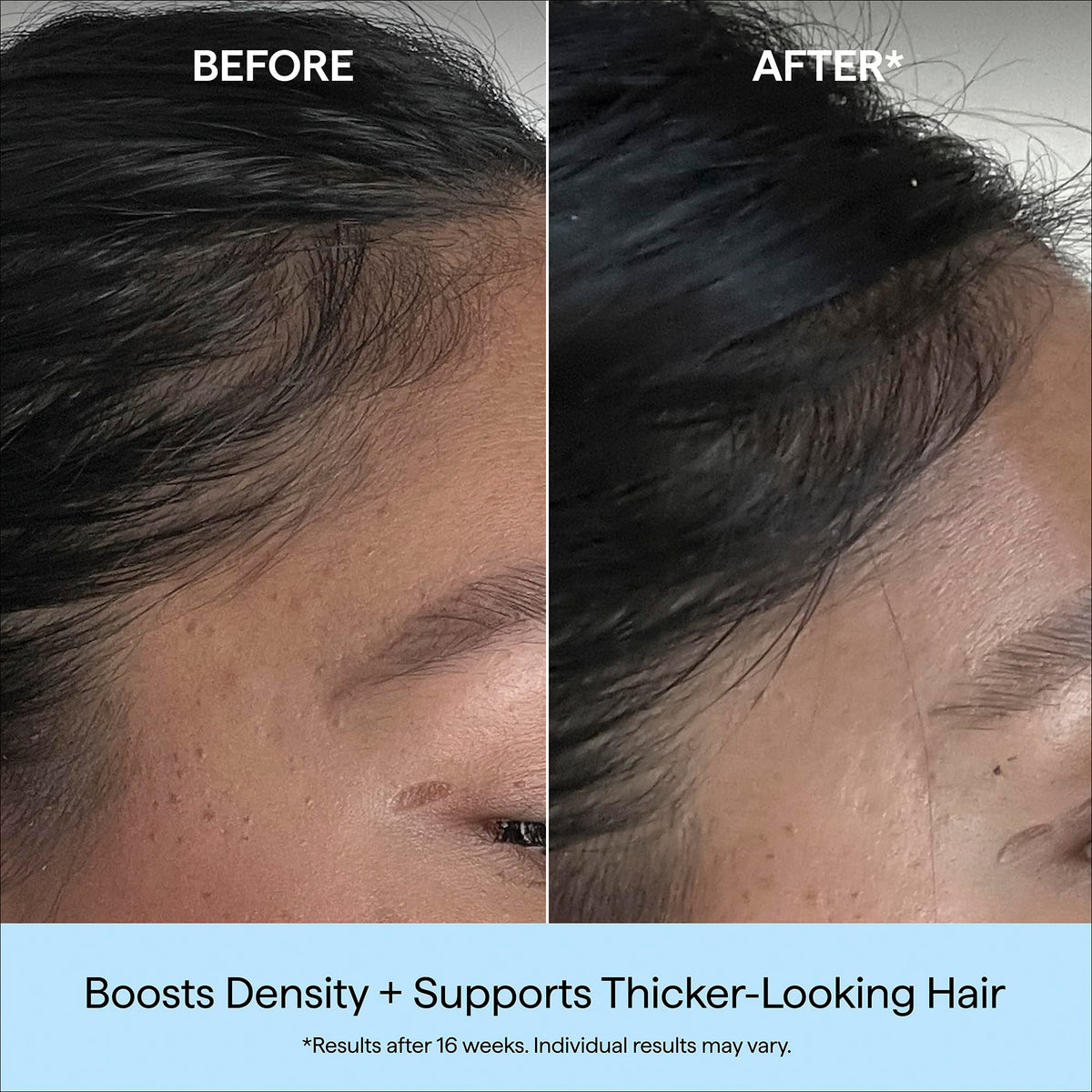 Briogeo applying serum to scalp to encourage fuller-looking hair
