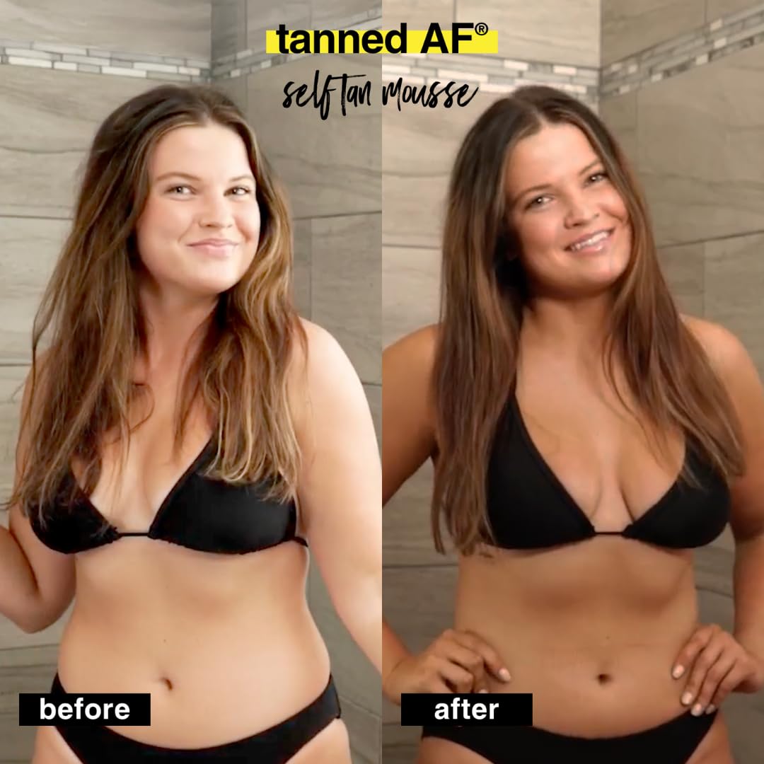 B.TAN before and after arm comparison highlighting deep bronzed result