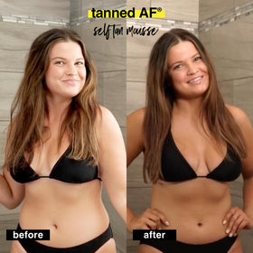 B.TAN before and after arm comparison highlighting deep bronzed result