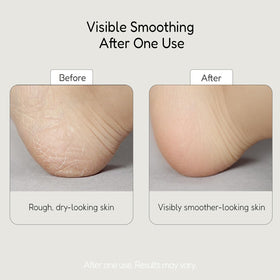 BUFFOUT before and after feet comparison showing smoother heel texture