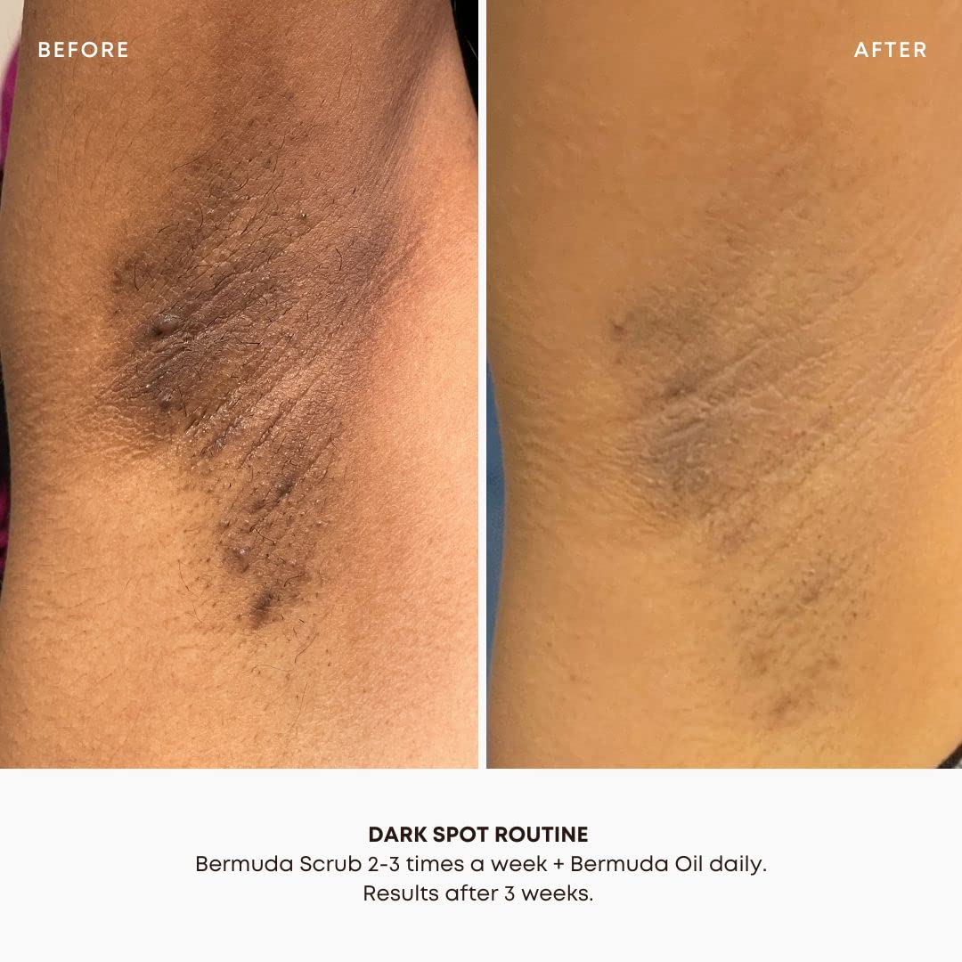 Bushbalm Bermuda oil dropper releasing a drop to soothe and hydrate skin